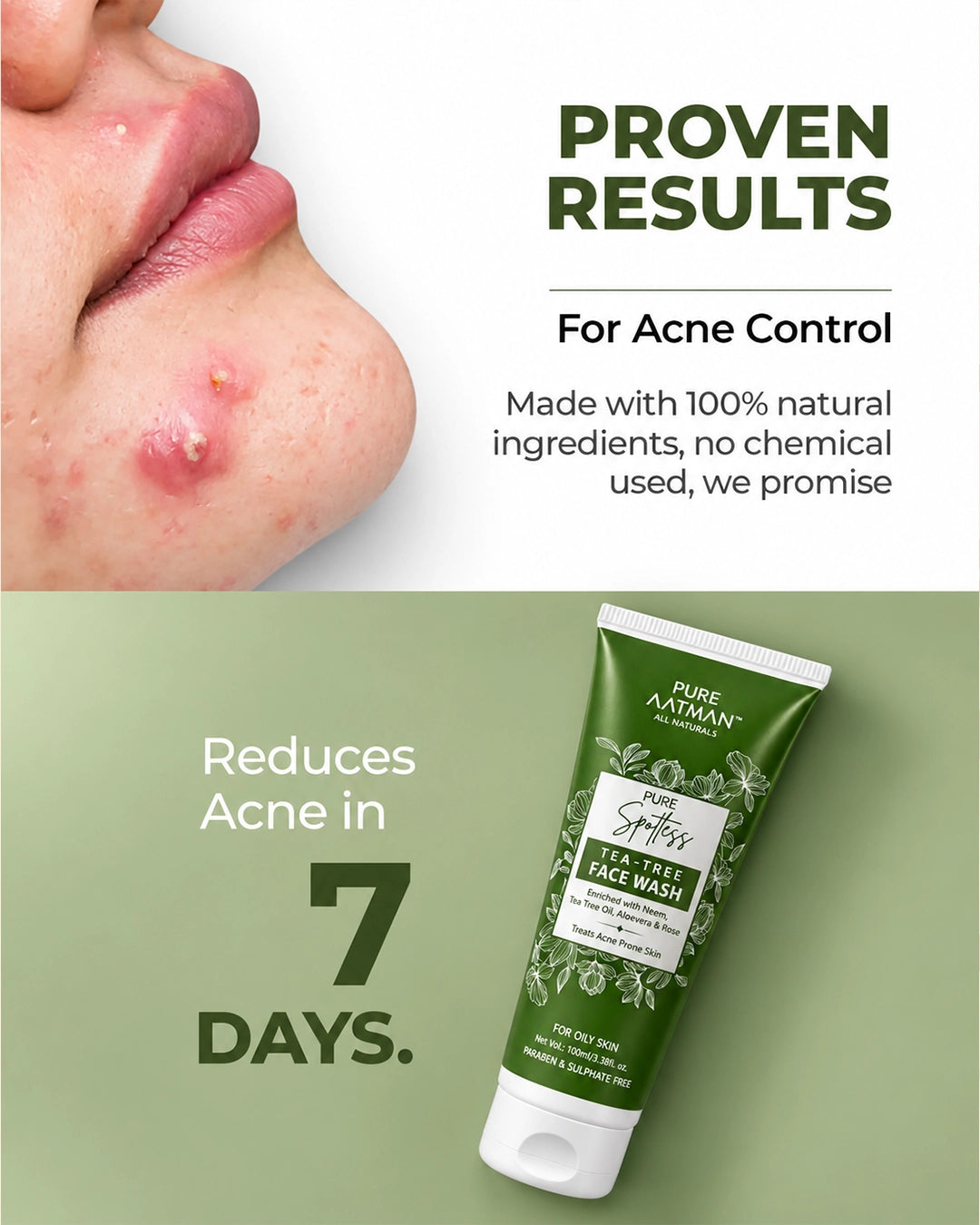 Tea Tree Oil & Aloevera Face Wash removes Oil, Acne & Pimples 100 ml - 100 ml
