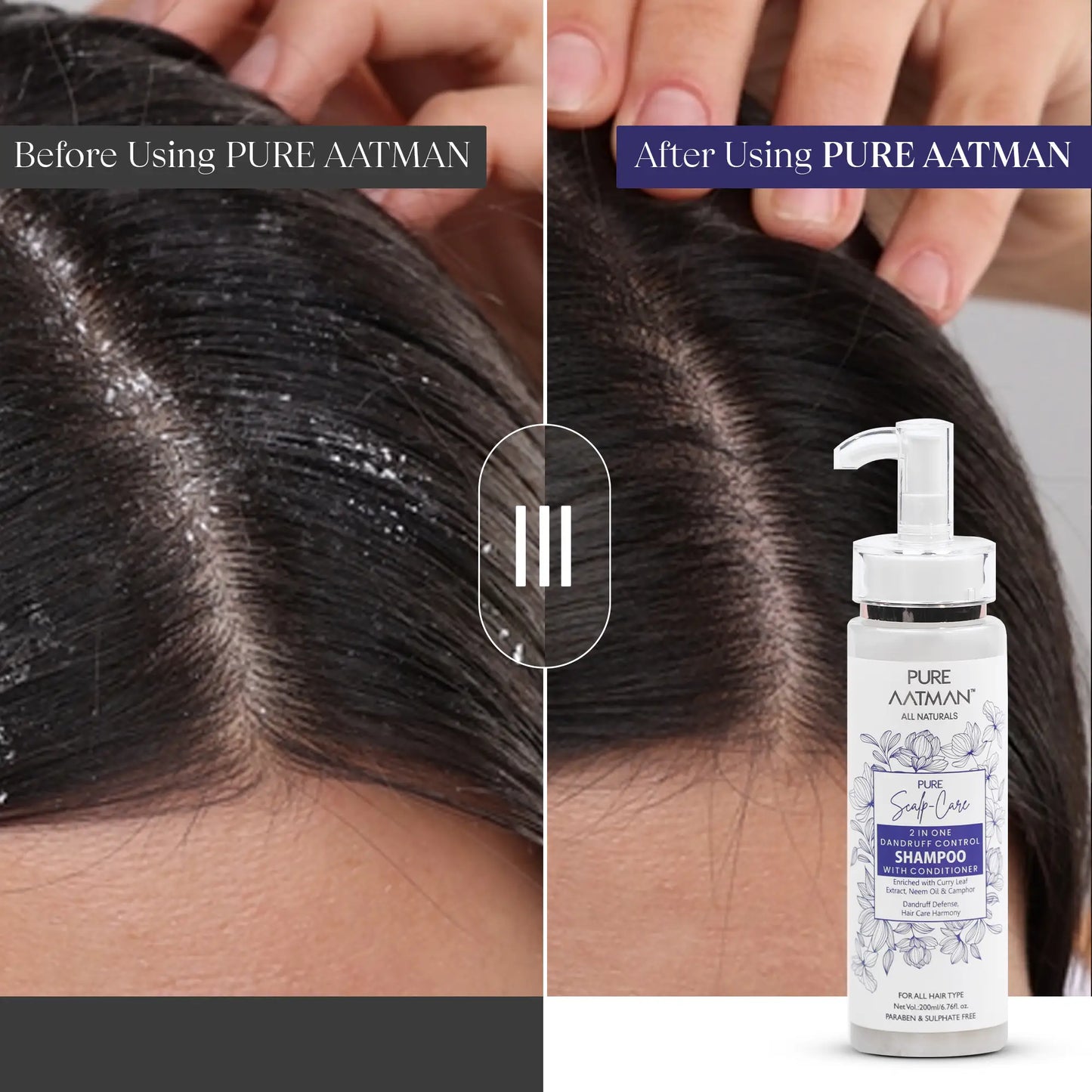 2 in 1 Dandruff & Hair fall control Neem Oil & Camphor Shampoo & Conditioner | Reduce Scalp Irritation | Paraben & Sulphate FREE | Suitable for All Hair Types | 200ml