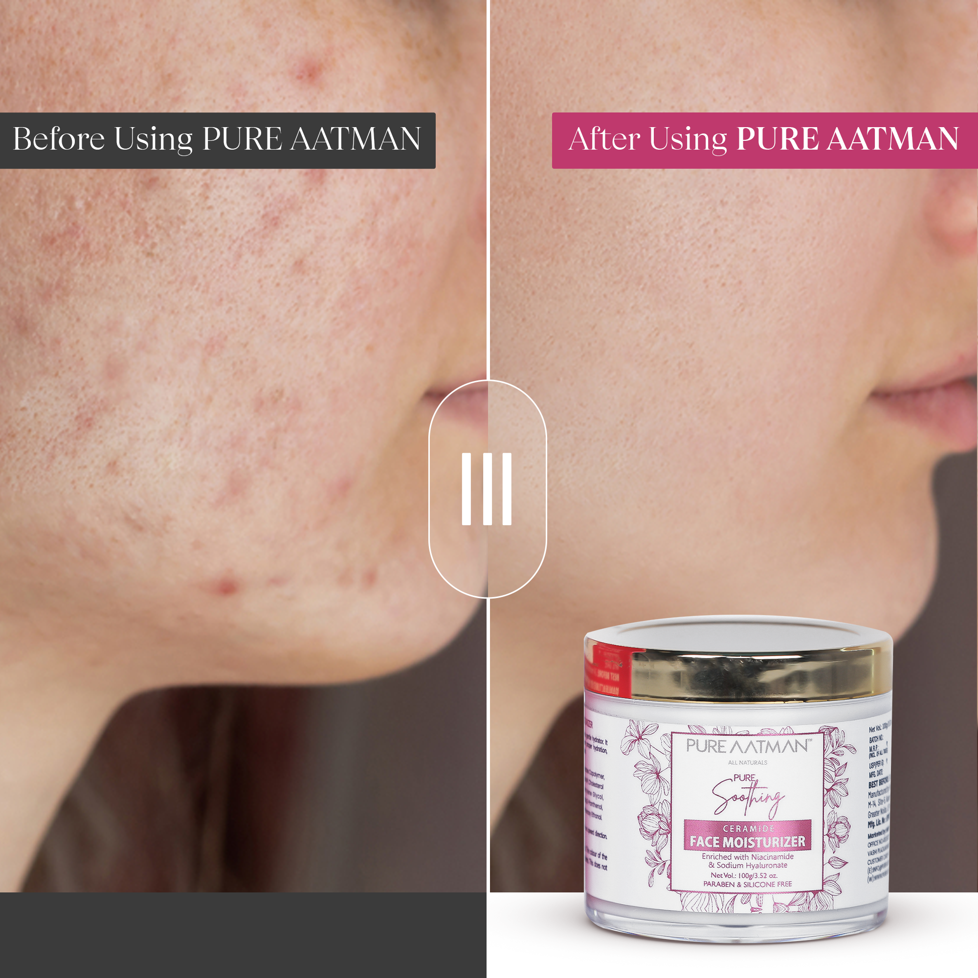 Pure Aatman Soothing Ceramide Face Moisturizer Enriched with Niacinamide & Sodium Hyaluronate