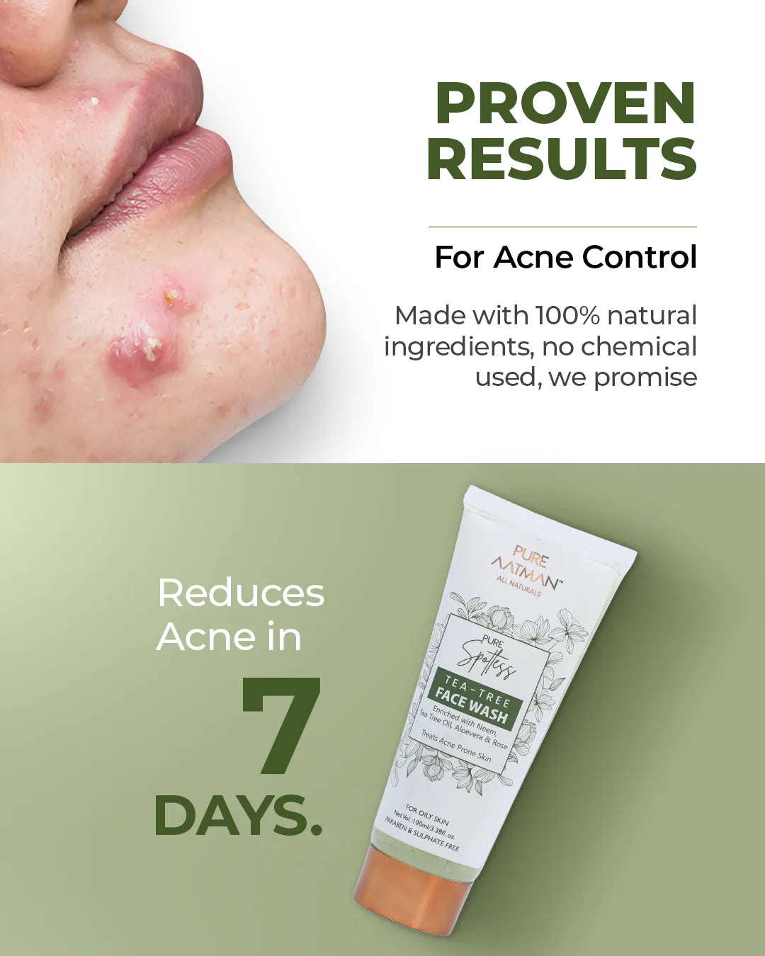 Tea Tree Oil & Aloevera Face Wash removes Oil, Acne & Pimples 100 ml - For Normal & Dry Skin, 100 ml