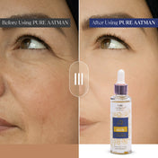 Pure Aatman Kumkumadi Face Oil 40ml| Enriched with Blue Lotus| Best Ayurvedic Herbal Face Oil For uneven skin tone, dry skin & Dark Spots, For men and women
