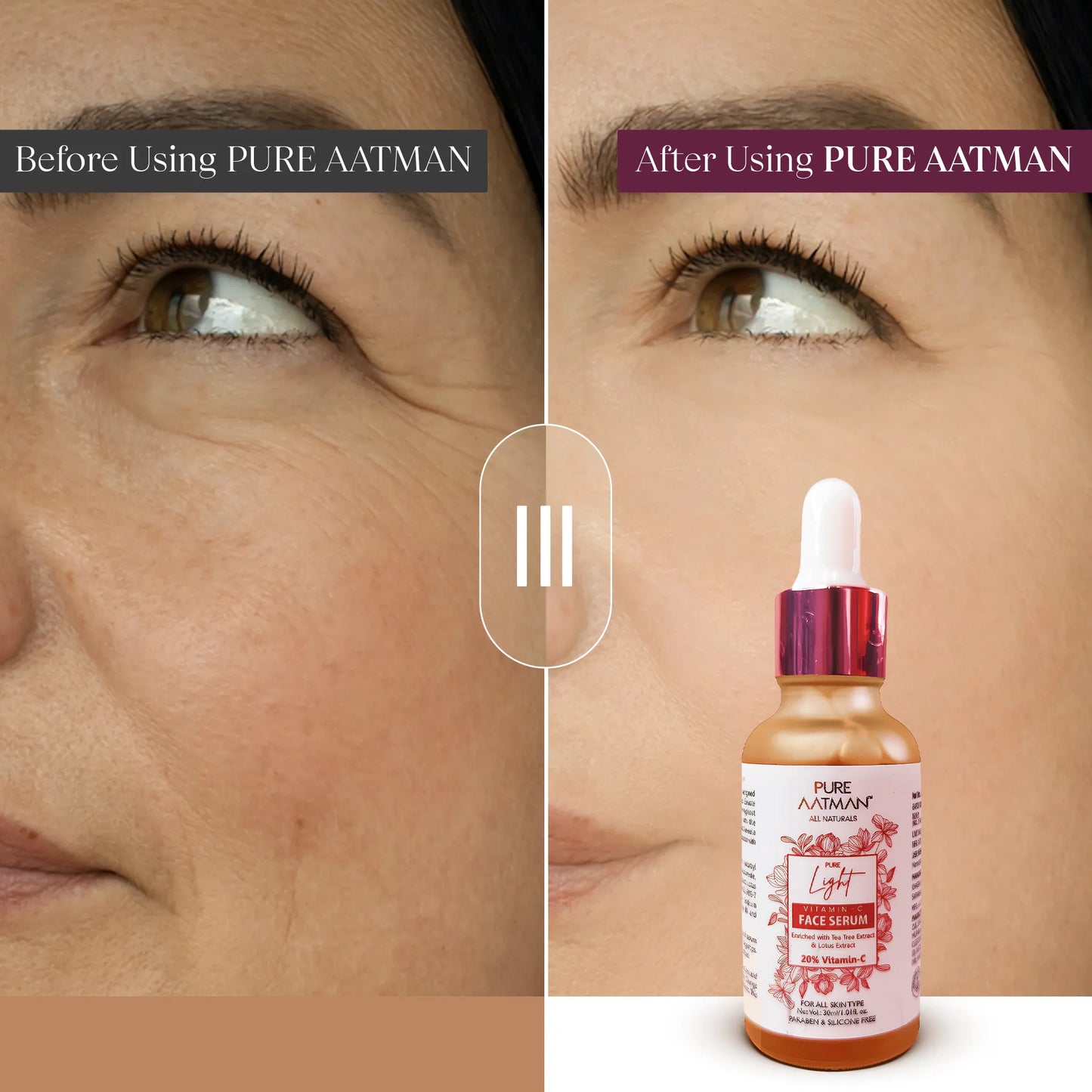20% Vitamin C Face Serum for brightening and glowing skin | Reduces Hyperpigmentation, Anti Aging & Skin Repair | For Dark Circles & Fine Lines| 30 ml | Suitable for all skin type