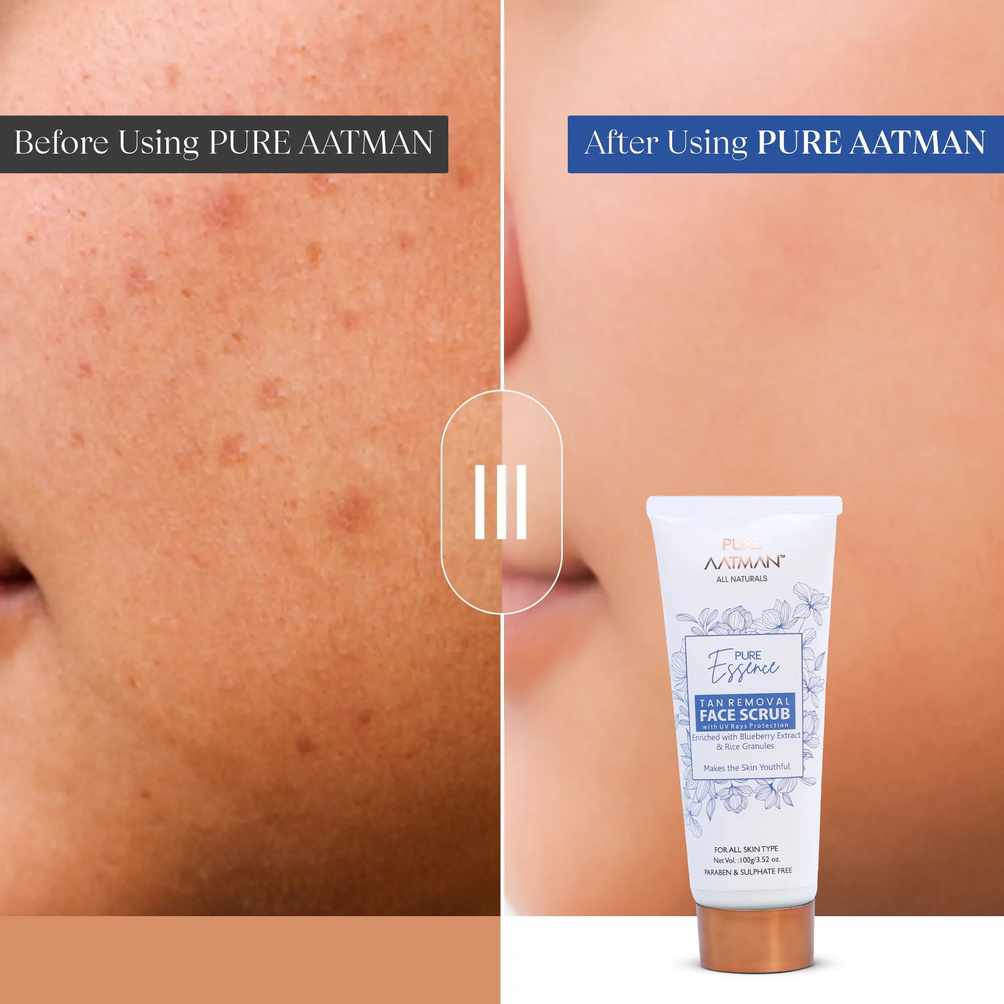 Tan Removal Scrub with blueberry and rice extract | Gentle Exfoliator | Removes Tan and Blackheads | 100gm