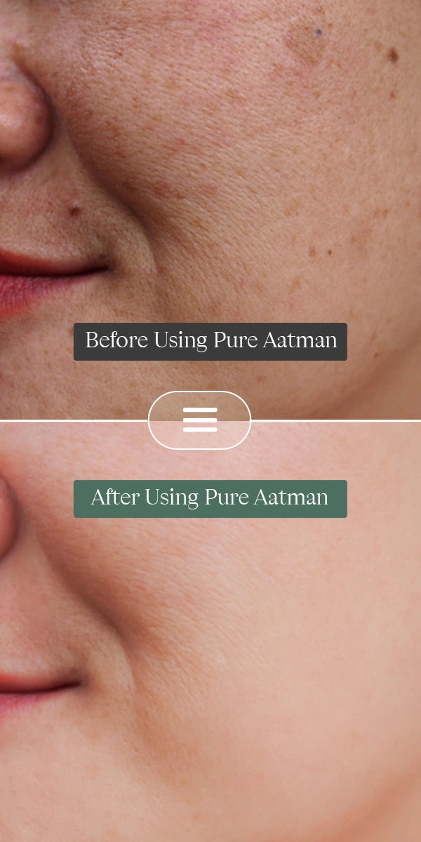 Before_After_1.webp