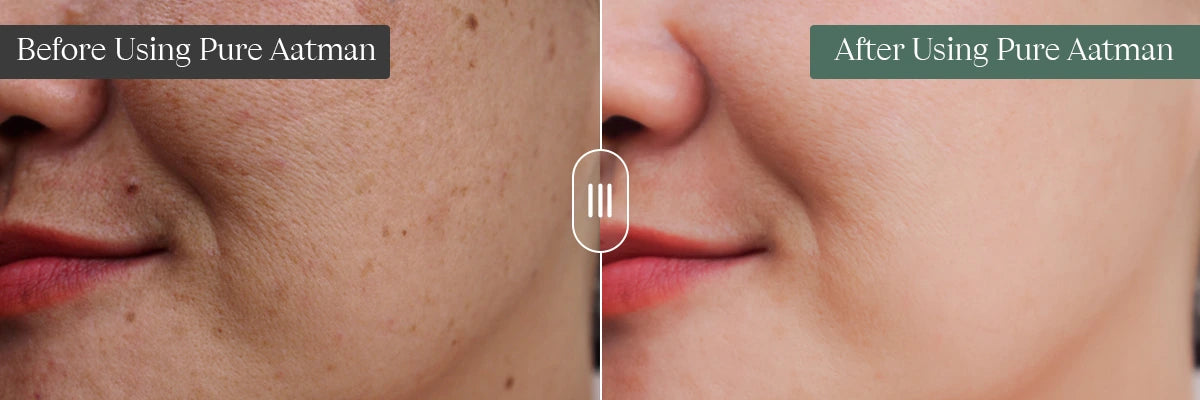 Before_After_2.webp