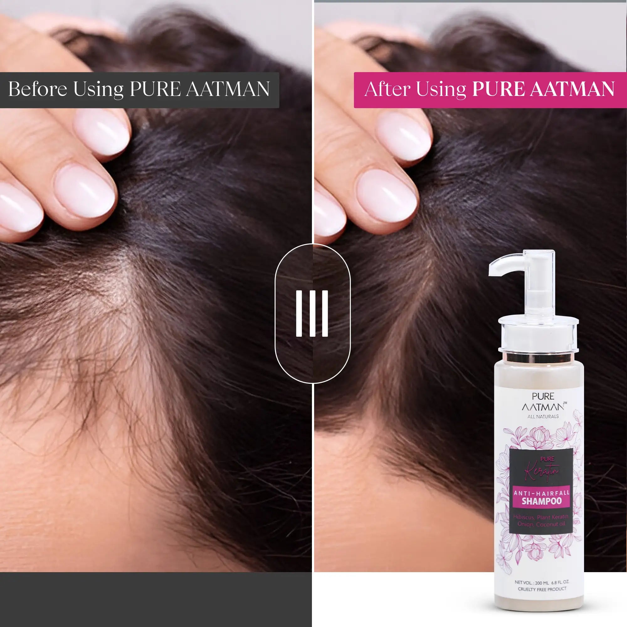 Keratin Hair Fall Shampoo for Hair Growth & Hair Fall Control, with Hibiscus Oil & Plant Keratin 200ml