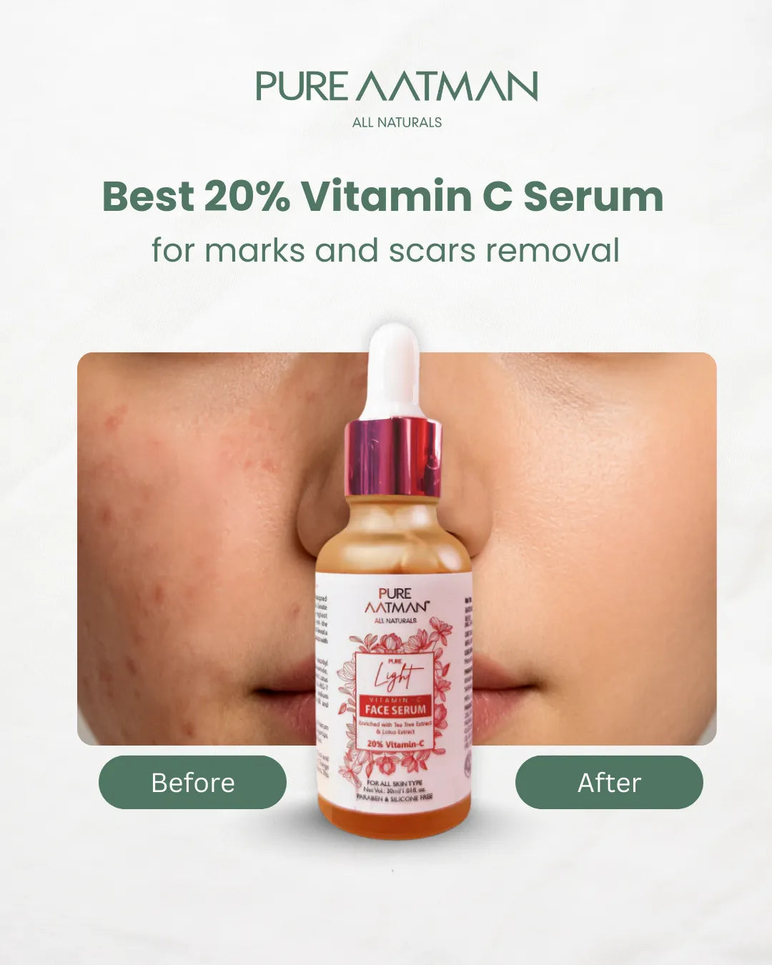 20% Vitamin C Face Serum for brightening and glowing skin | Reduces Hyperpigmentation, Anti Aging & Skin Repair | For Dark Circles & Fine Lines| 30 ml | Suitable for all skin type
