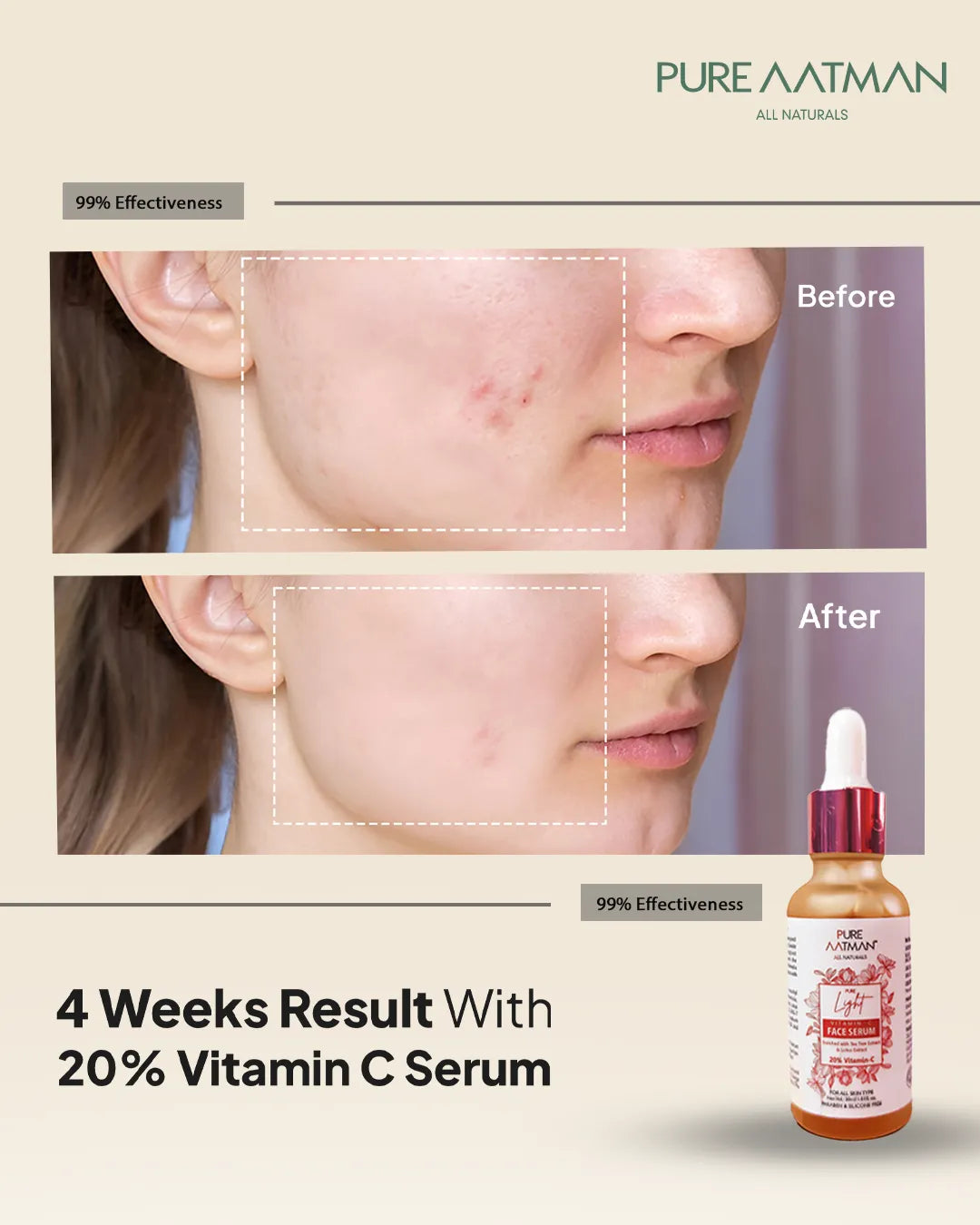 20% Vitamin C Face Serum for brightening and glowing skin | Reduces Hyperpigmentation, Anti Aging & Skin Repair | For Dark Circles & Fine Lines| 30 ml | Suitable for all skin type