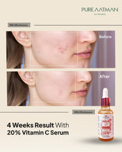 20% Vitamin C Face Serum for brightening and glowing skin | Reduces Hyperpigmentation, Anti Aging & Skin Repair | For Dark Circles & Fine Lines| 30 ml | Suitable for all skin type