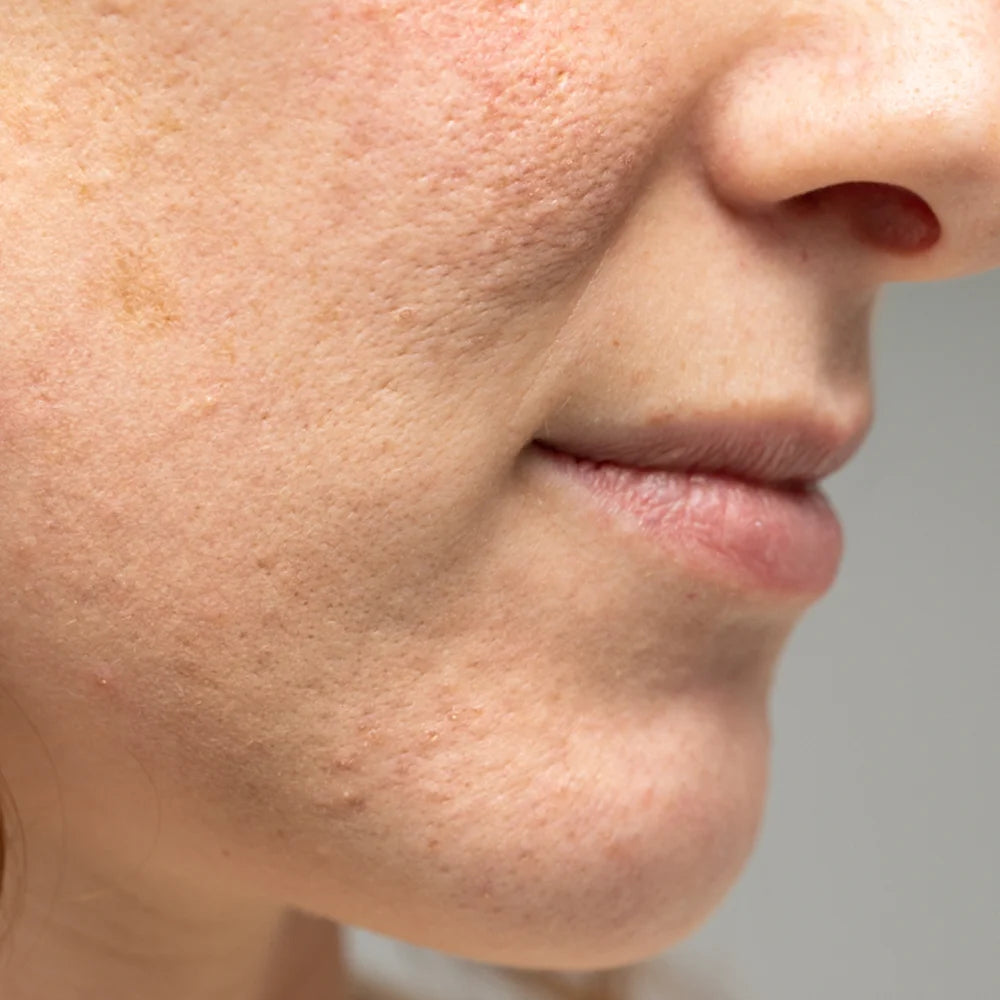 anti_ageing.webp