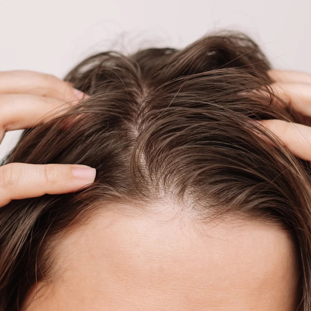 oily_scalp.webp